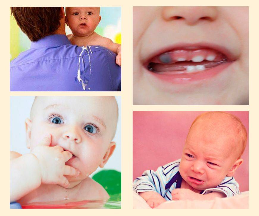 Лечение пульпита зубов – что это такое: как лечат заболевание в стоматологии и нужно ли удаление нерва