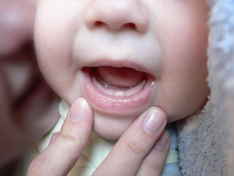 Как лезут зубы у детей: последовательность