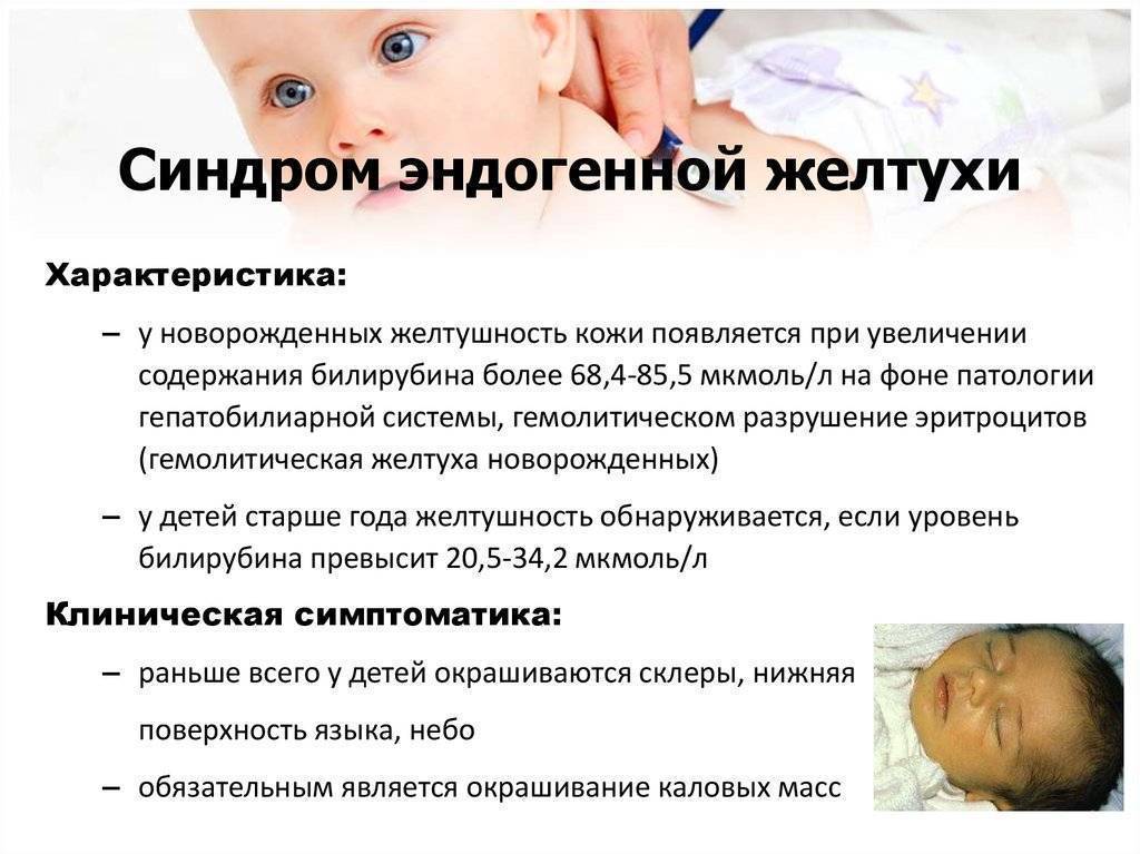 Желтуха у новорожденных: причины и последствия, когда должна пройти, лечение - medside.ru