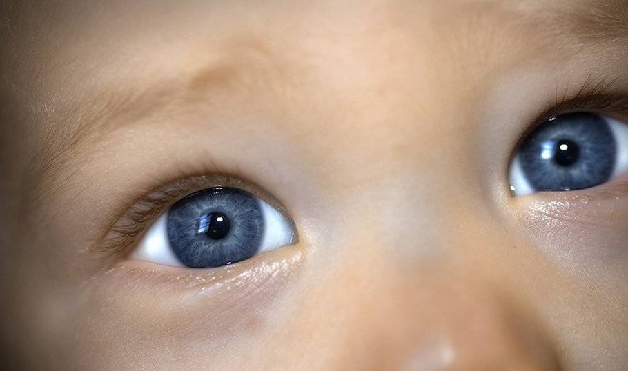 ᐈ почему у детей появляются синяки под глазами?| медицентр