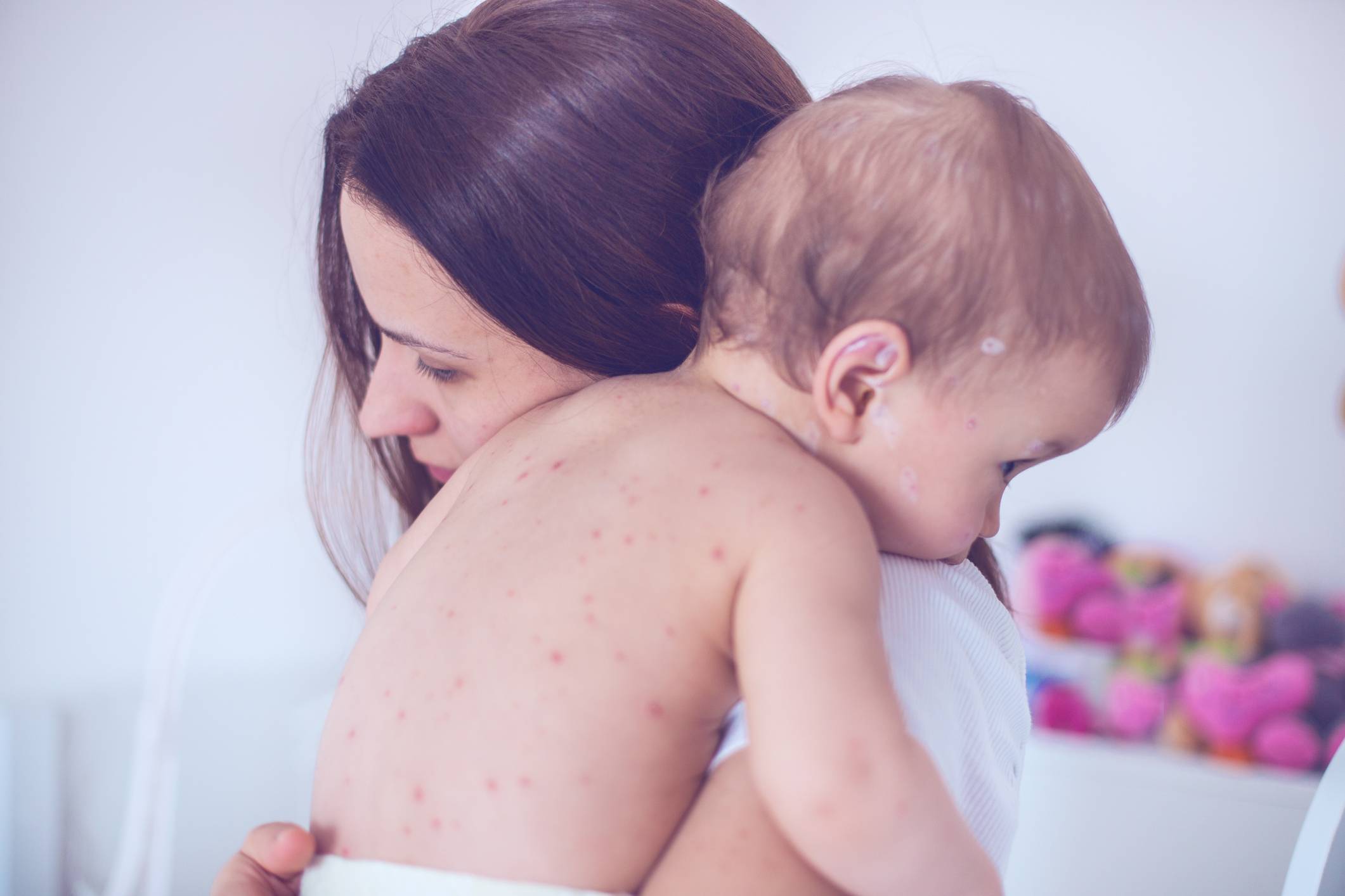 Аллергия на щеках у новорожденного