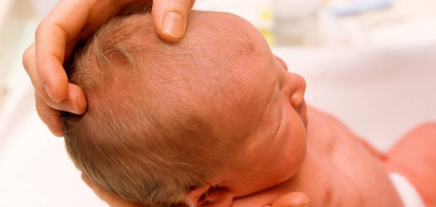 Родничок у новорожденных | как ухаживать за родничком у новорожденного
