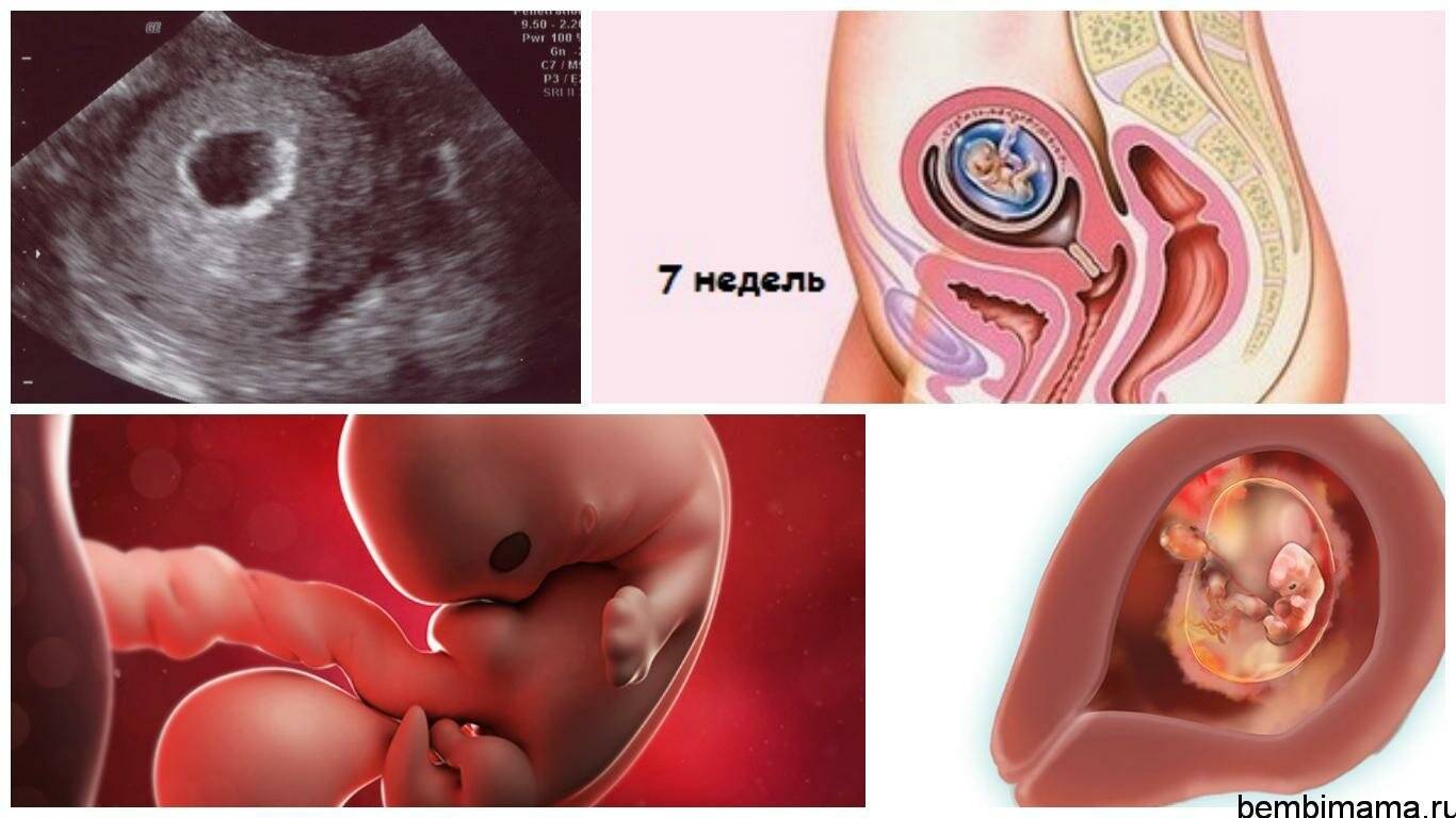 11 недель беременности – что происходит, развитие плода, ощущения, как выглядит живот - agulife.ru
