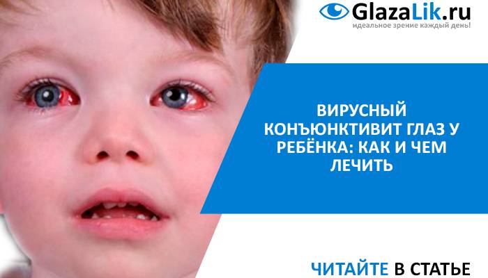 Глазные капли при гнойном конъюнктивите у детей - энциклопедия ochkov.net