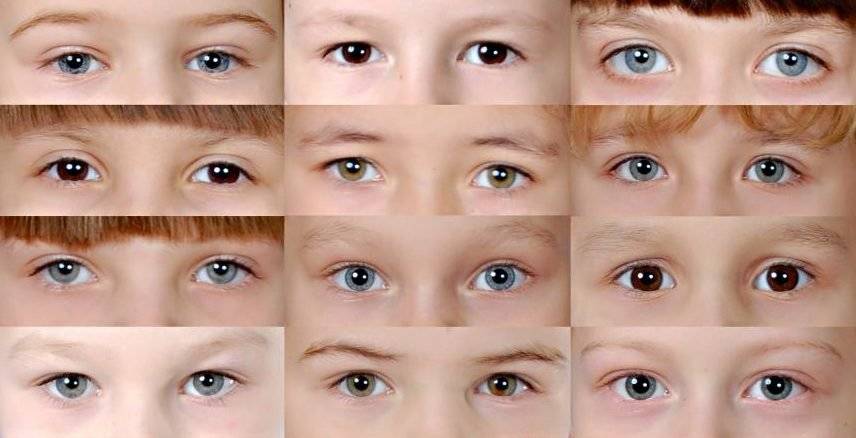Когда меняется цвет глаз у новорожденных детей и от чего он зависит? ~
