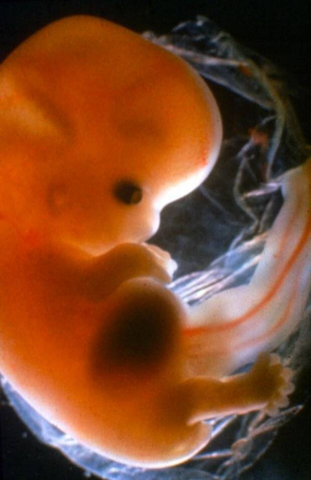 Как выглядит зародыш в 12 недель беременности фото