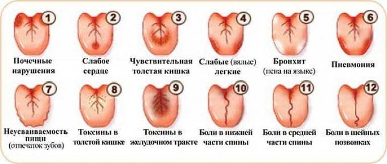 Глоссит - лечение, симптомы, причины - smile4you.ru