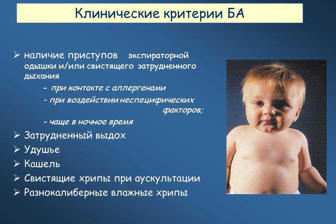 Причины и лечение хрипов у грудного ребенка