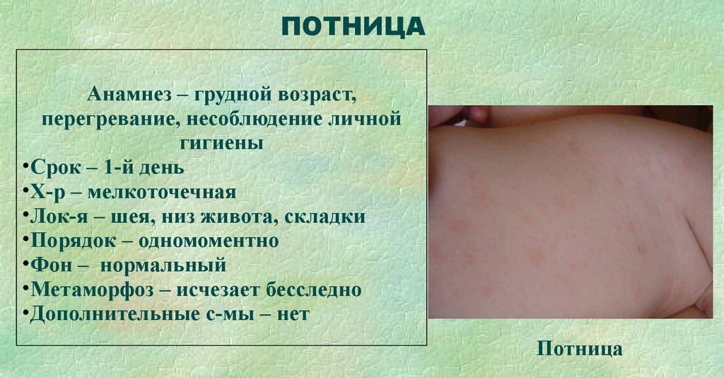 Сыпь и температура у ребенка: 11 ведущих причин и советы педиатра