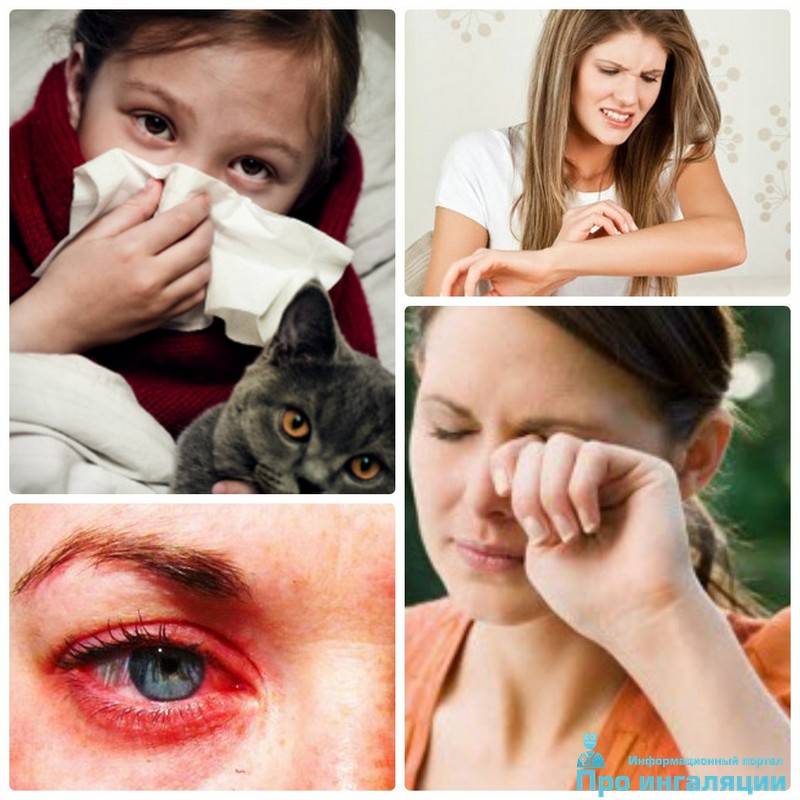 Аллергия на кошек. симптомы, причины и лечение аллергии на кошек у детей