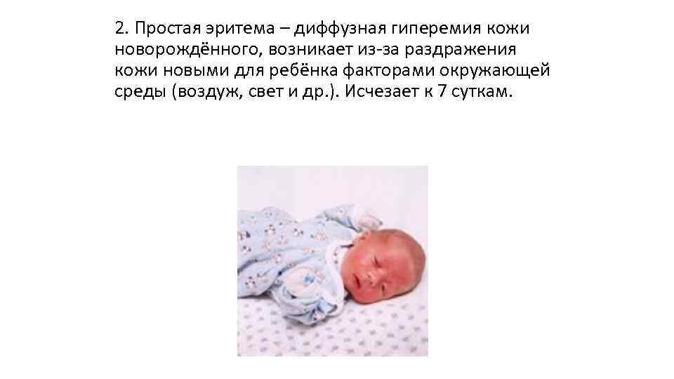 Физиологическая и гемолитическая желтуха новорожденных. разбираемся в отличиях. | nutrilak