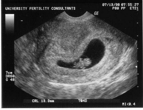 8 месяц беременности – что происходит с малышом, живот на восьмом месяце беременности, с какой недели начинается - agulife.ru