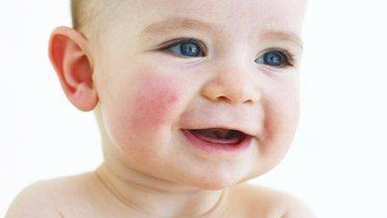 Чем лечить пеленочный дерматит у детей: кремы и мази от раздражения от подгузников