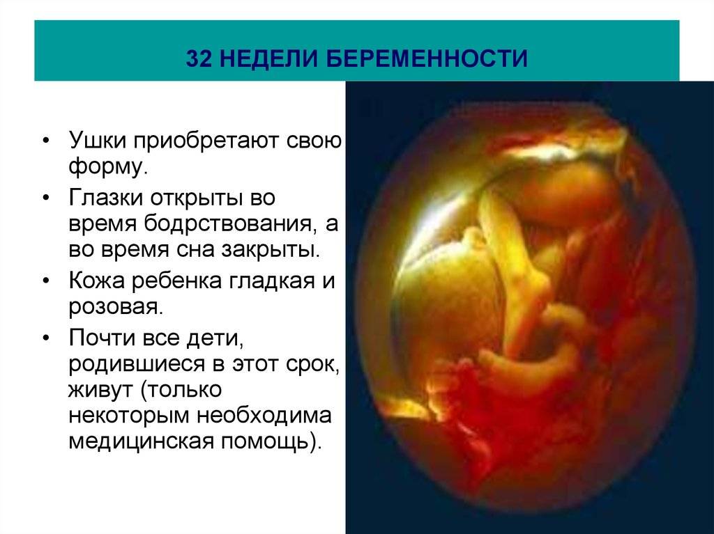 ➤ 32 неделя беременности всё что нужно знать будущей маме