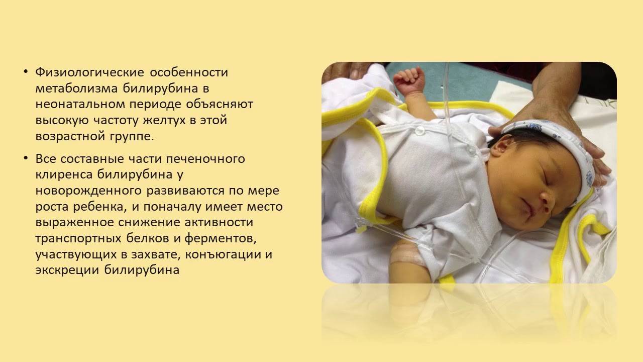Физиологическая желтуха новорожденных и гемолитическая. разбираемся в отличиях.