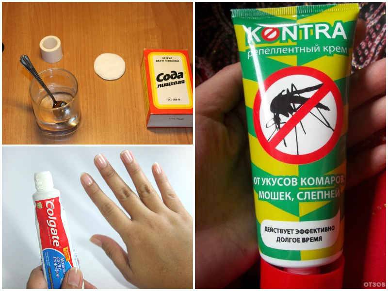 Как защитить ребенка от укусов комаров: 13 шагов