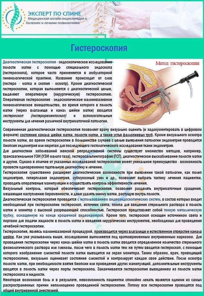 Гистероскопия с биопсией эндометрия - подготовка, показания, противопоказания | университетская клиника
