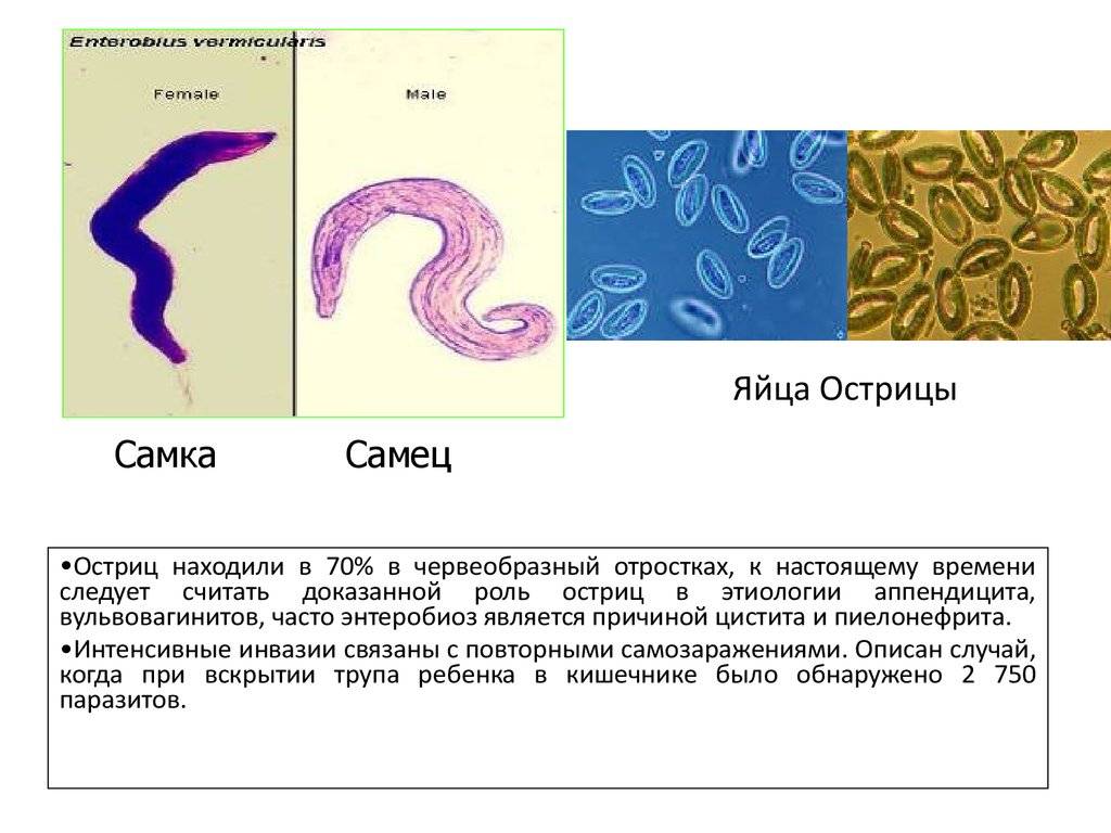 Фото острицы у детей симптомы и лечение