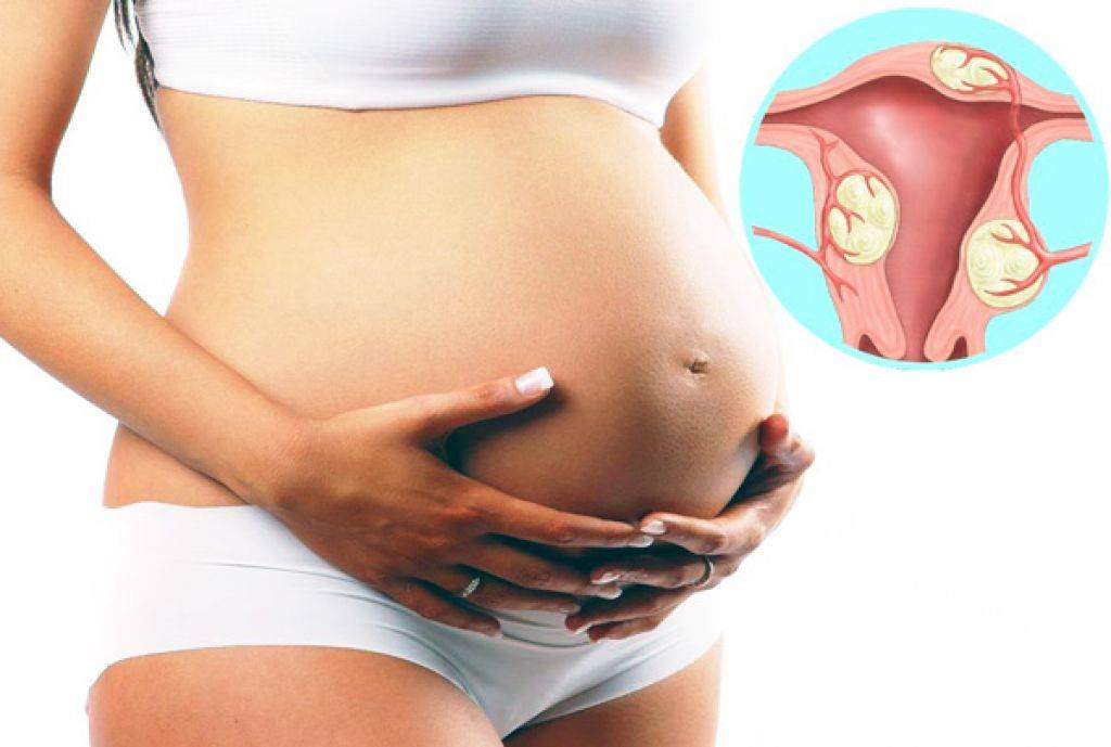 Как выглядит беременность в матке фото