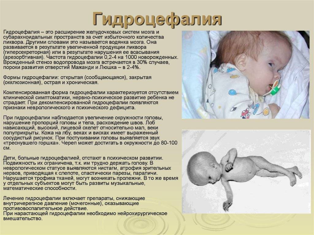 Лечение эпилепсии у детей и новорожденных | центр диагностики нейропсихологических заболеваний и отклонений у детей epihelp