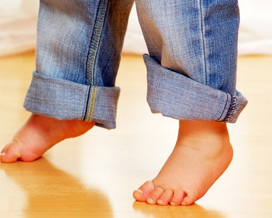 Ребенок ходит на носочках: что делать?