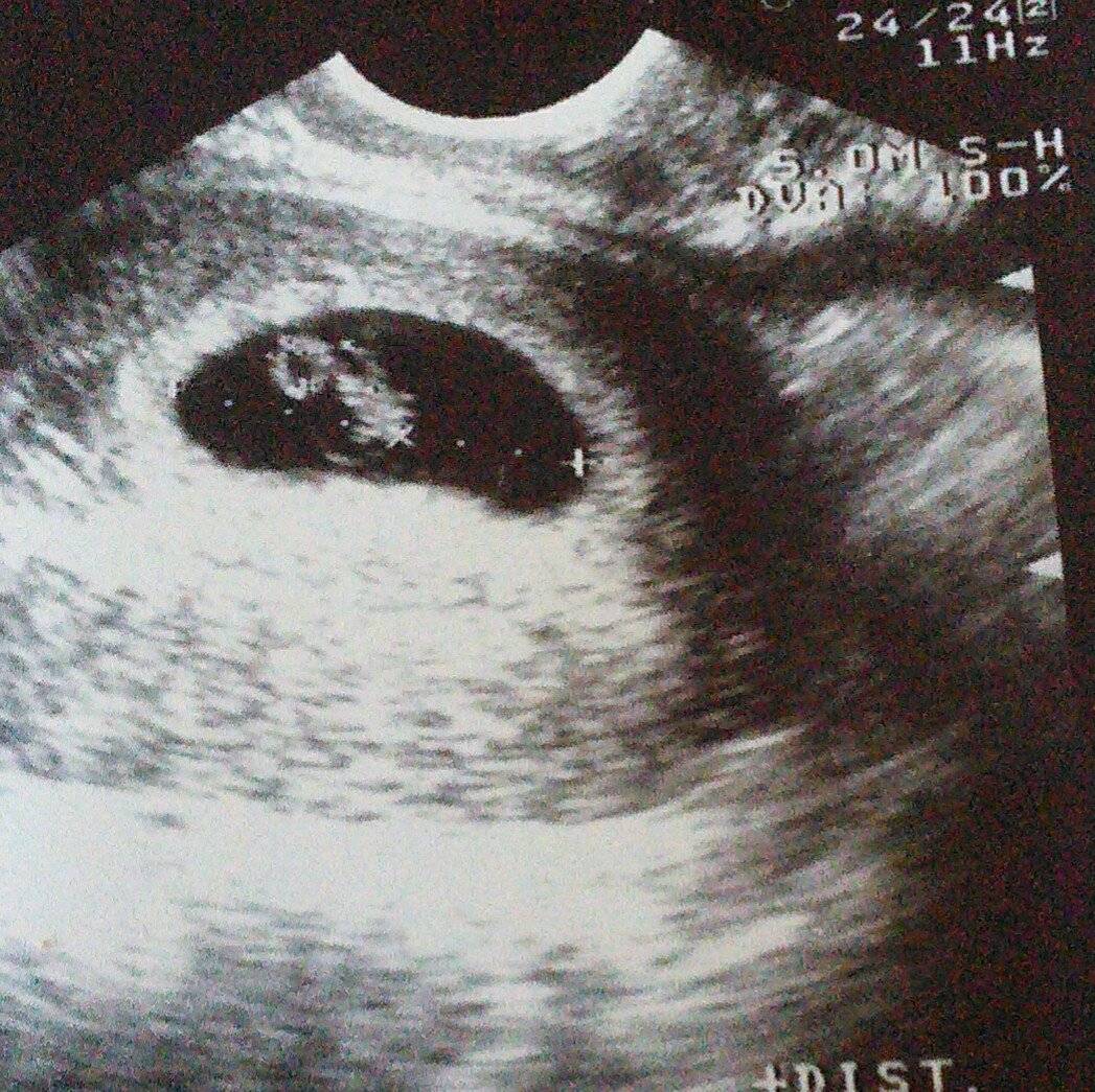 7 неделе беременности: что происходит с ребенком, развитие, размер живота и плода, выделения у мамы, эмбрион на узи / mama66.ru
