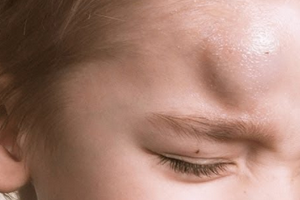 Почему ребенок хмурит брови 1 год