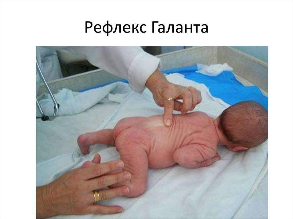 Презентация на тему "безусловные рефлексы новорожденных"