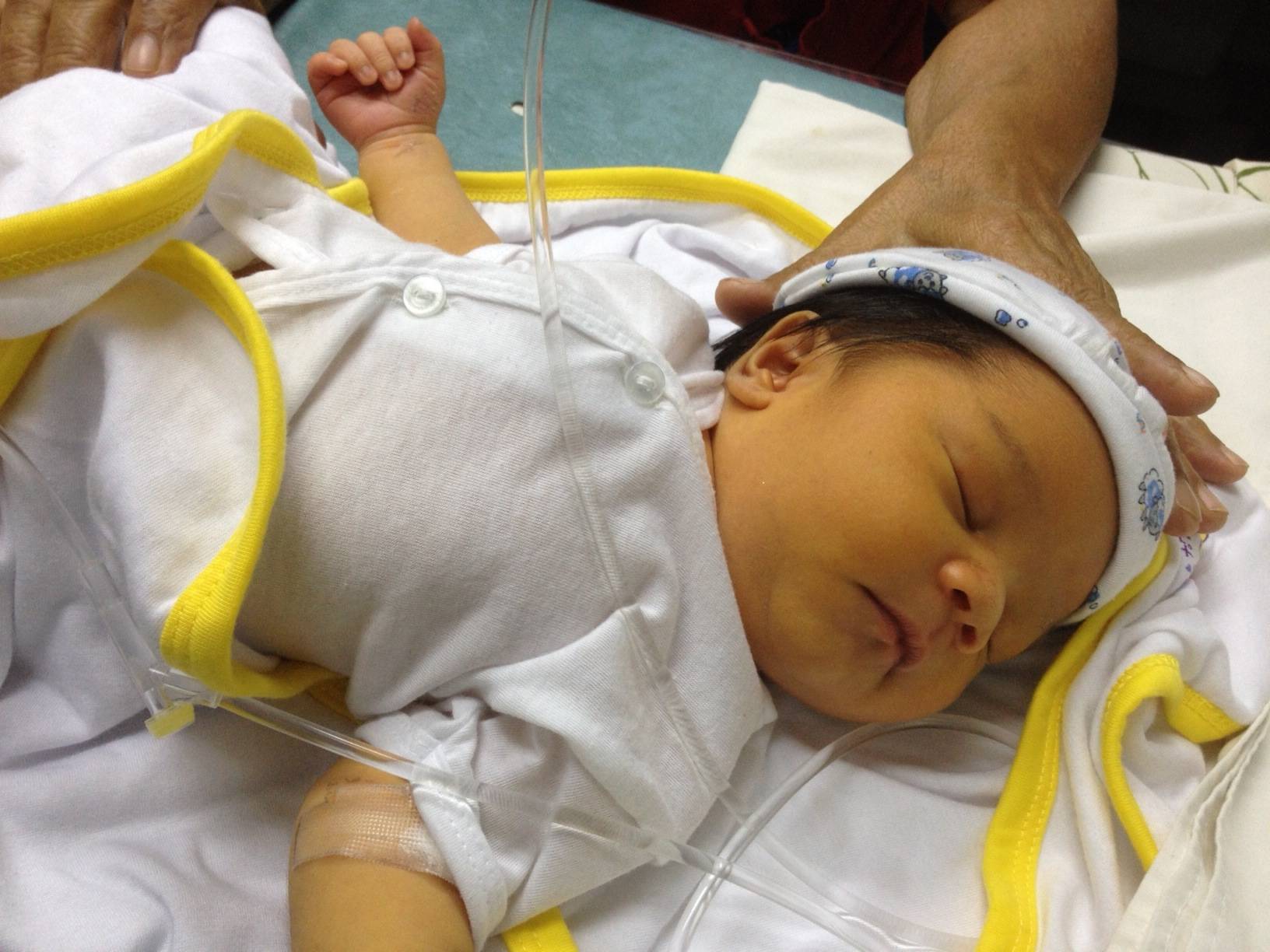 Билирубин у новорожденных: норма, отклонения, лечение желтухи