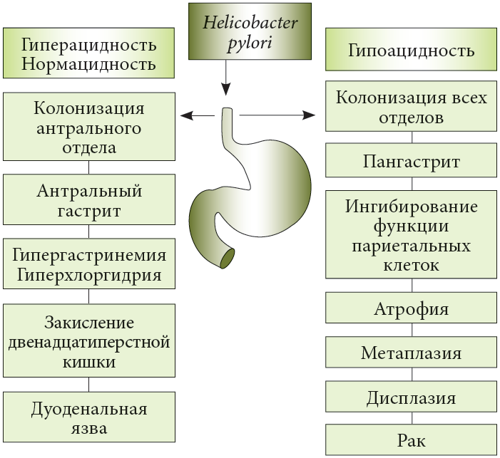 Язва у детей
