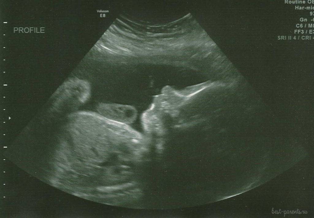 28 неделя беременности – что происходит, развитие плода, живот на двадцать восьмой неделе беременности - agulife.ru