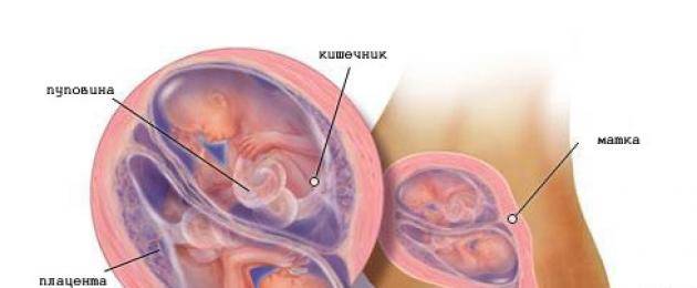 12 неделя беременности двойней | nestle baby